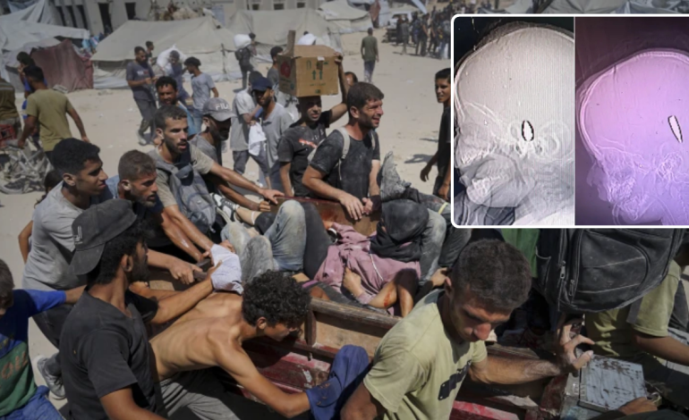  Ballered Children in Gaza: BBC Research apunta a los crímenes de guerra

 – Panorama 24